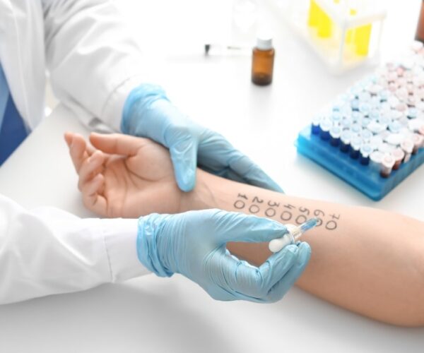 Allergy-and-Sensitivity-Testing