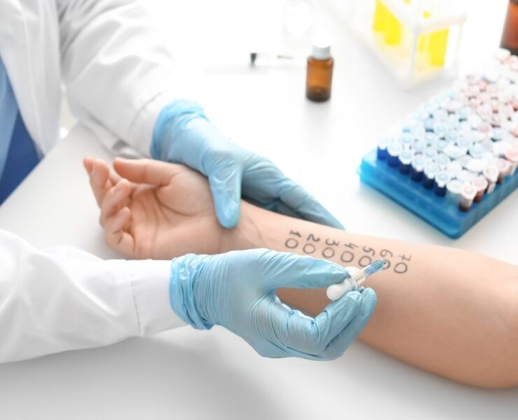 Allergy-and-Sensitivity-Testing